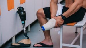 Amputee wearing a custom prosthetic socket designed for comfort and mobility