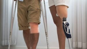 above-knee-residual-limb-care
