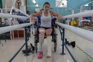 One of the most common sources of stress after limb loss is uncertainty.