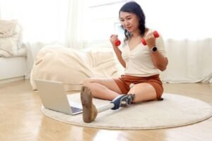Life After Amputation