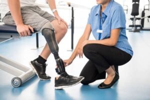 amputation recovery