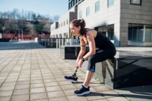 Limb Loss and Grief