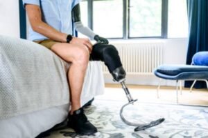 Adapt Your Home After Limb Loss