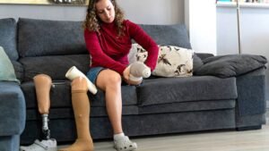 Amputee overcoming frustration and setbacks during life after amputation