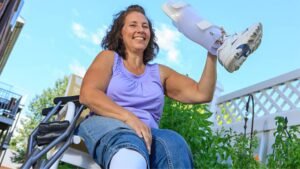 Rediscovering Confidence After Limb Loss